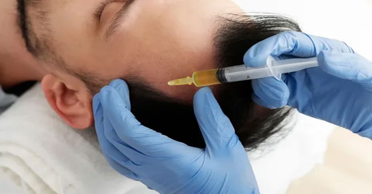 Platelet Rich Plasma Treatment