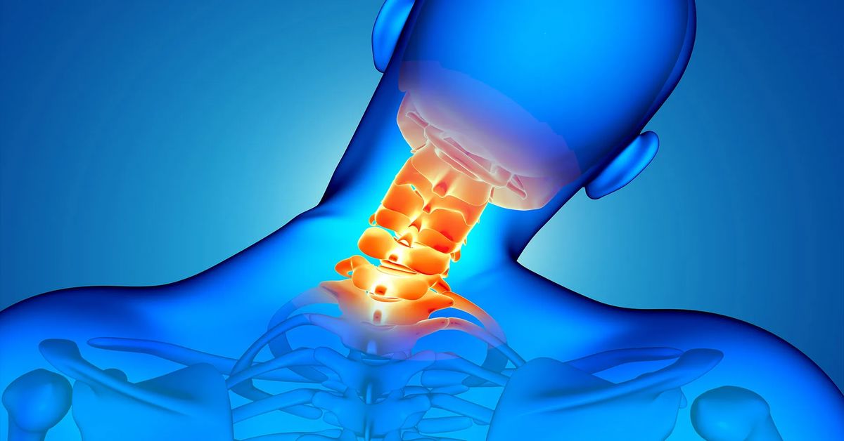 Boyun Ağrısı Tedavisi Nasıl Yapılır?