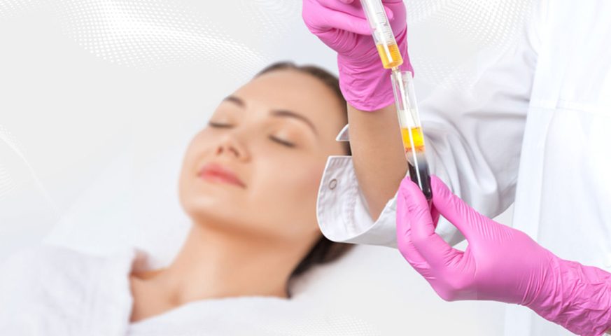Platelet Rich Plasma Tedavisi Nedir?