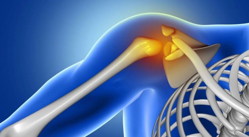 Eklem Çıkığı Tedavisi