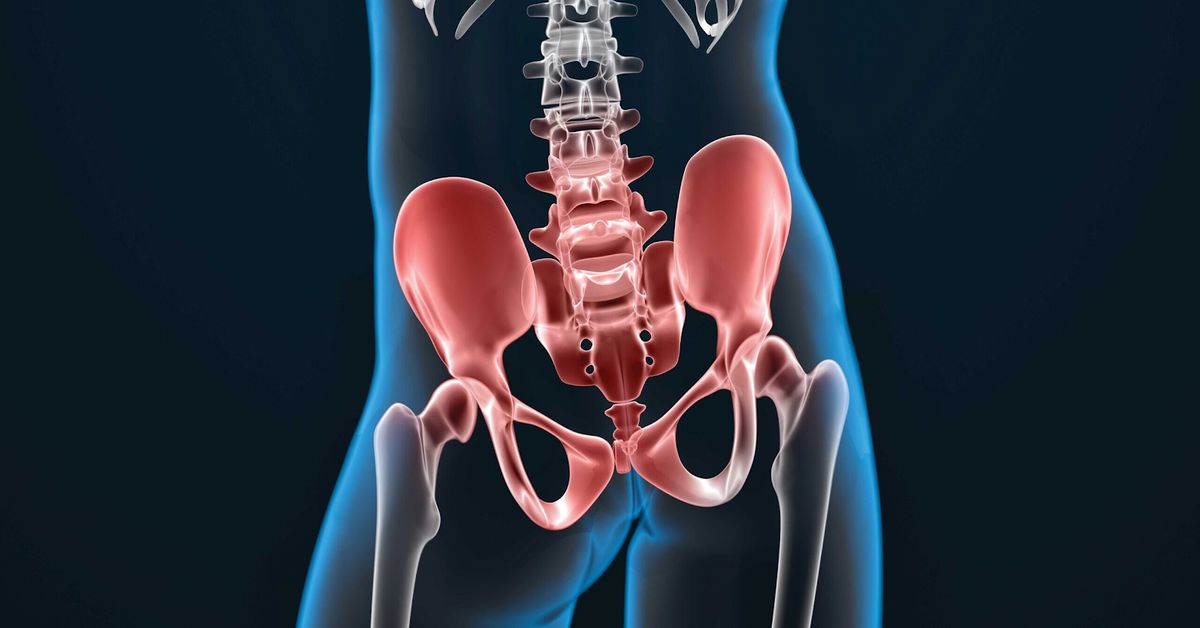 Kalça Kireçlenmesi Tedavisi