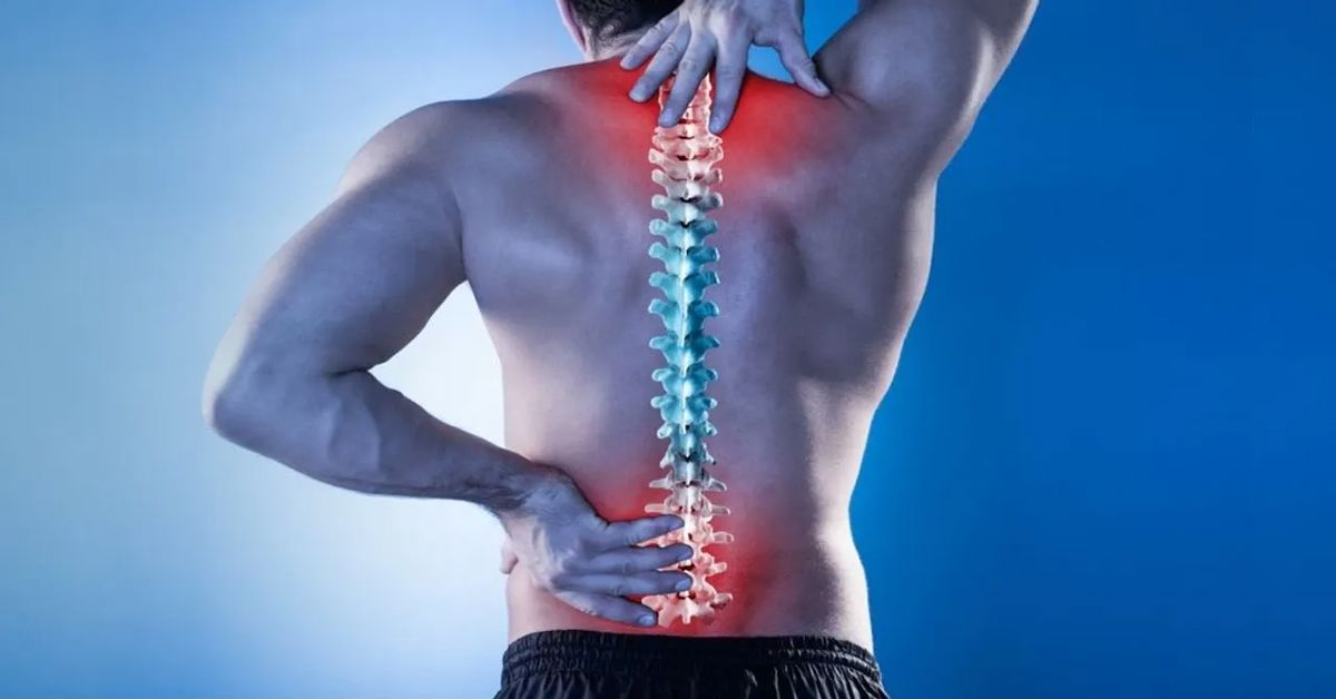 Bel Fıtığı Neden Olur?