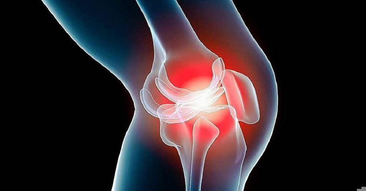 Diz Kireçlenmesi Belirtileri