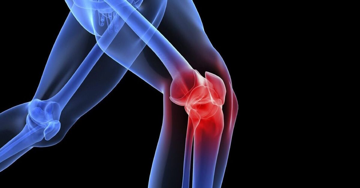 Diz Kireçlenmesi Belirtileri