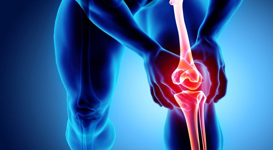 Diz Kireçlenmesi Belirtileri