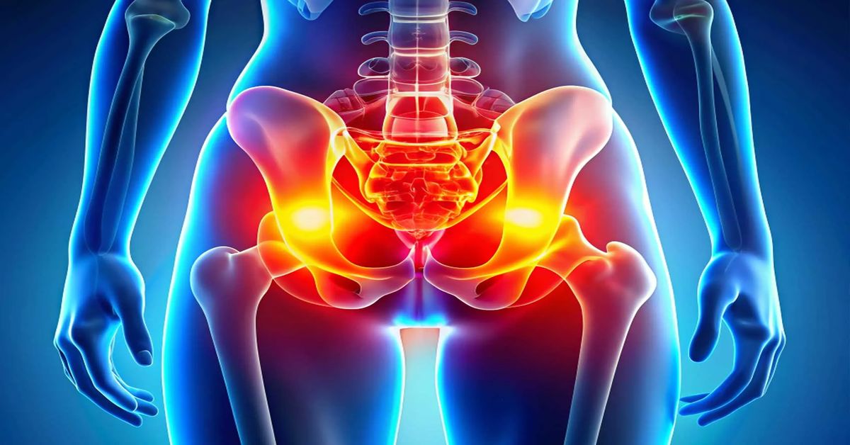 Kalça Kireçlenmesi Belirtileri