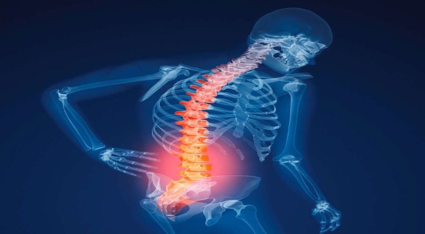 Osteoporosis Treatment